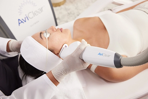 Patient receiving AviClear acne laser treatment to the face
