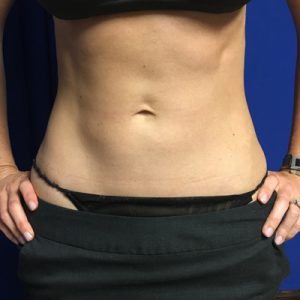 21761-90403 21761-90403