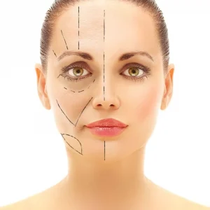 face-fat