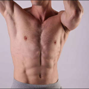 male-tummy-tuc 008 male-tummy-tuc 008